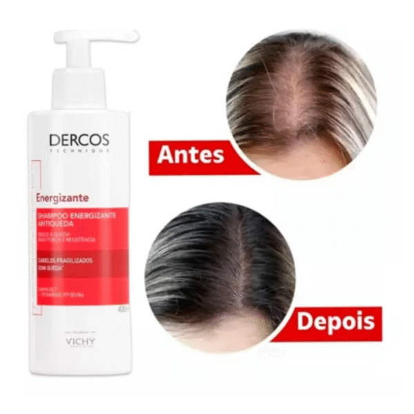 Kit Dercos Shampoo + Condicionador + Super Ampola + Sérum - Imagem 3